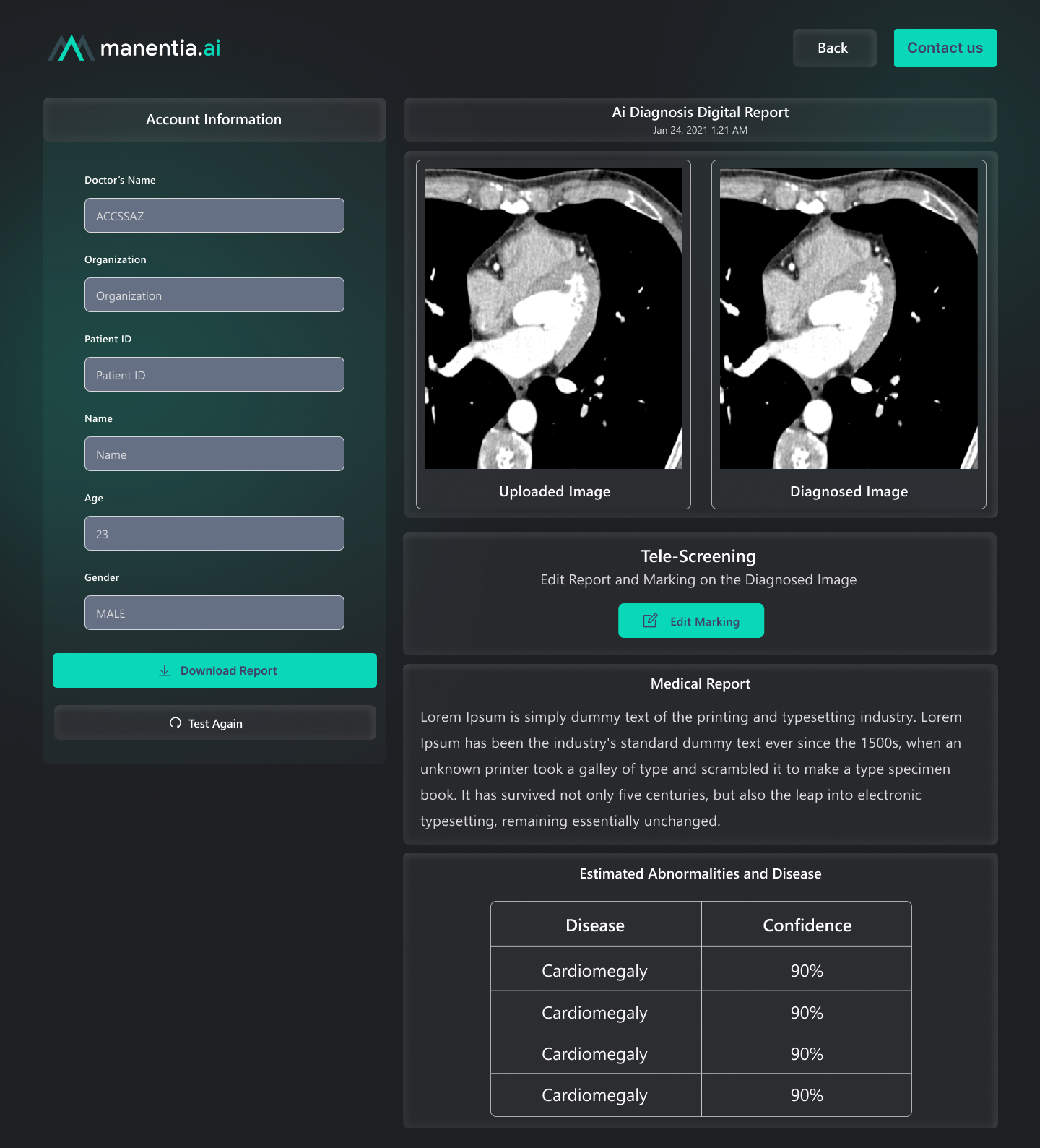 Manentia AI diagnostic-imaging interface, showing uploaded and AI-diagnosed chest CT scans side by side with an estimated abnormalities and confidence panel below